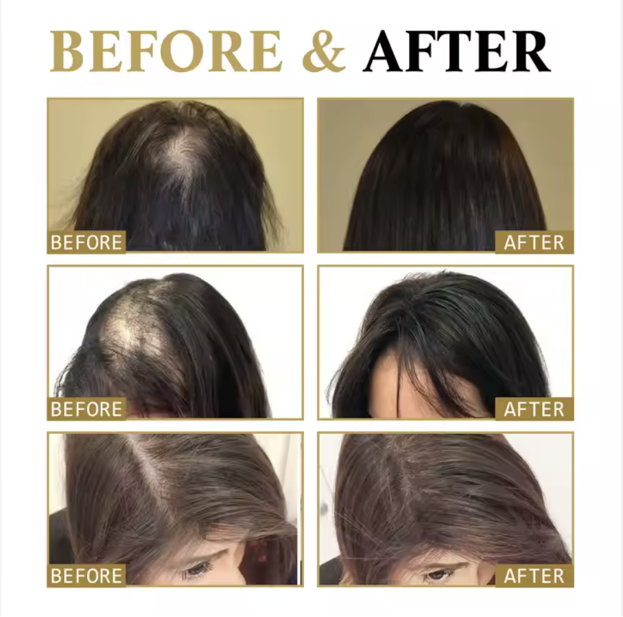 Miniatura 7 de ESENCIA CAPILAR ANTI CALVICIE